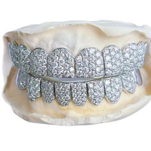 customized full diamond braces